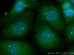 SKP1 Antibody in Immunocytochemistry (ICC/IF)