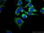 LONP1 Antibody in Immunocytochemistry (ICC/IF)