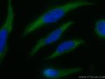 NCALD Antibody in Immunocytochemistry (ICC/IF)