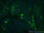 Cytokeratin 13 Antibody in Immunohistochemistry (Paraffin) (IHC (P))