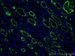 AQP1 Antibody in Immunohistochemistry (Paraffin) (IHC (P))