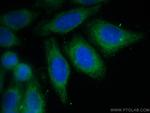 TDRKH Antibody in Immunocytochemistry (ICC/IF)