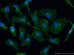 CD98/SLC3A2 Antibody in Immunocytochemistry (ICC/IF)