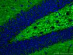 Synaptophysin Antibody in Immunohistochemistry (Paraffin) (IHC (P))