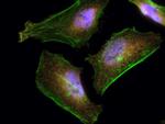 IRAK1 Antibody in Immunocytochemistry (ICC/IF)