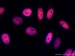 MECP2 Antibody in Immunocytochemistry (ICC/IF)