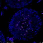 TNP1 Antibody in Immunohistochemistry (Paraffin) (IHC (P))