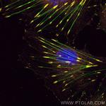 FAK Antibody in Immunocytochemistry (ICC/IF)