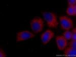 PLOD3 Antibody in Immunocytochemistry (ICC/IF)