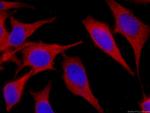 SEC5/EXOC2 Antibody in Immunocytochemistry (ICC/IF)