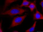 EIF3D Antibody in Immunocytochemistry (ICC/IF)