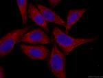 Melanophilin Antibody in Immunocytochemistry (ICC/IF)