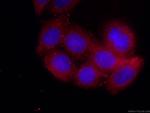 AFM Antibody in Immunocytochemistry (ICC/IF)