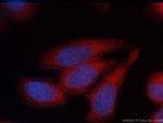 Annexin V Antibody in Immunocytochemistry (ICC/IF)