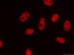 NUDT21 Antibody in Immunocytochemistry (ICC/IF)