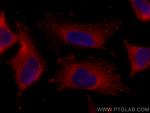 ATG13 Antibody in Immunocytochemistry (ICC/IF)