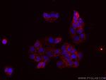 MFN1 Antibody in Immunocytochemistry (ICC/IF)