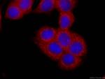 PTPN11 Antibody in Immunocytochemistry (ICC/IF)