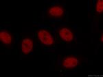 TCF3 Antibody in Immunocytochemistry (ICC/IF)