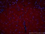 GRIA1 Antibody in Immunohistochemistry (PFA fixed) (IHC (PFA))