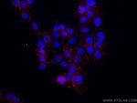 Occludin Antibody in Immunocytochemistry (ICC/IF)