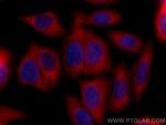 CTP synthase Antibody in Immunocytochemistry (ICC/IF)