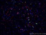 CD34 Antibody in Immunohistochemistry (Paraffin) (IHC (P))