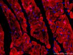 FABP3 Antibody in Immunohistochemistry (Paraffin) (IHC (P))