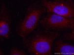 Sestrin 2 Antibody in Immunocytochemistry (ICC/IF)