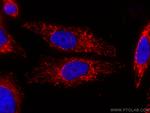 ATPB Antibody in Immunocytochemistry (ICC/IF)