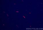 TTPA Antibody in Immunohistochemistry (Paraffin) (IHC (P))