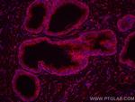 TAOK3 Antibody in Immunohistochemistry (Paraffin) (IHC (P))