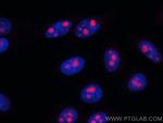 MYBBP1A Antibody in Immunocytochemistry (ICC/IF)