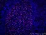 PD-1/CD279 Antibody in Immunohistochemistry (PFA fixed) (IHC (PFA))