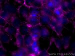 MTMR14 Antibody in Immunocytochemistry (ICC/IF)