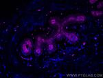 Cytokeratin 19 Antibody in Immunohistochemistry (Paraffin) (IHC (P))