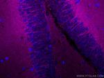 P2RY1 Antibody in Immunohistochemistry (Paraffin) (IHC (P))