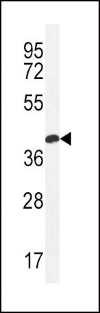 Claudin 16 Antibody in Western Blot (WB)