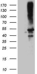 CLP1 Antibody in Western Blot (WB)
