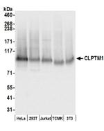 CLPTM1 Antibody in Western Blot (WB)