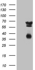 CLU Antibody in Western Blot (WB)