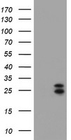 CMPK1 Antibody in Western Blot (WB)