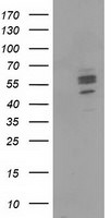 CNDP1 Antibody in Western Blot (WB)