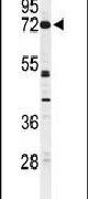 CNGA2 Antibody in Western Blot (WB)