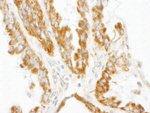 CNOT3 Antibody in Immunohistochemistry (IHC)