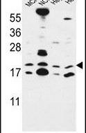 CNPY2 Antibody in Western Blot (WB)