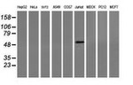 CORO1A Antibody in Western Blot (WB)