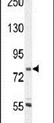 Coronin 7 Antibody in Western Blot (WB)