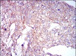 COTL1 Antibody in Immunohistochemistry (Paraffin) (IHC (P))