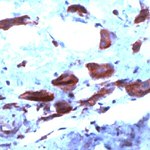 COX2 Antibody in Immunohistochemistry (Paraffin) (IHC (P))